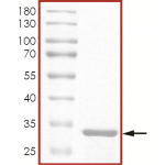 LCK Protein (SH3 domain)